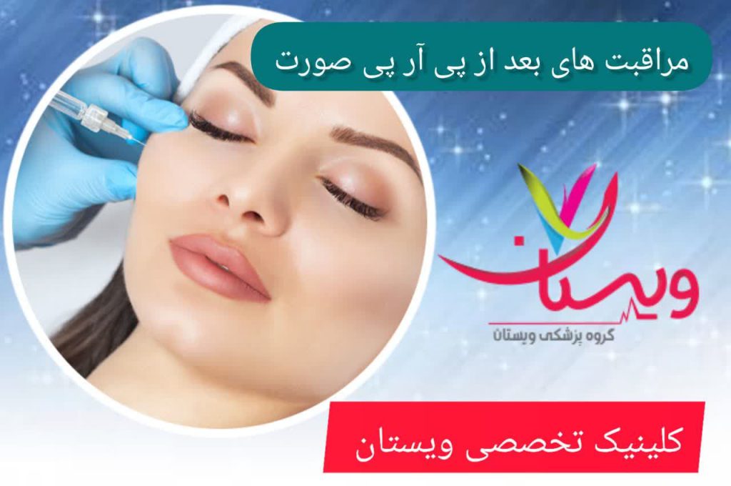 مراقبت های بعد از پی آر پی صورت مراقبت های بعد از پی آر پی صورت