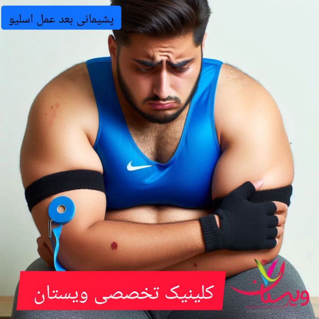 پشیمانی بعد از عمل اسلیو پشیمانی بعد از عمل اسلیو