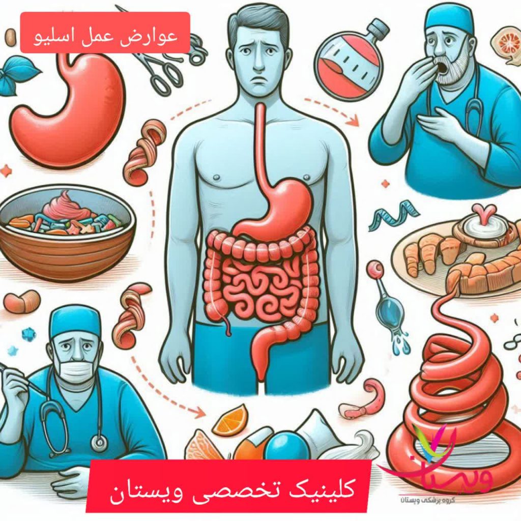 عوارض عمل اسلیو معده عوارض عمل اسلیو معده
