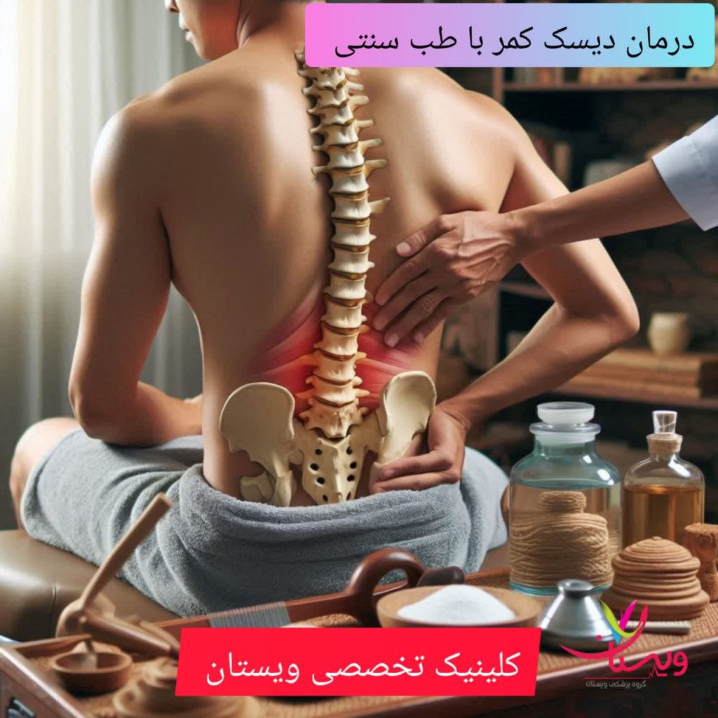 درمان دیسک کمر با طب سنتی درمان دیسک کمر با طب سنتی
