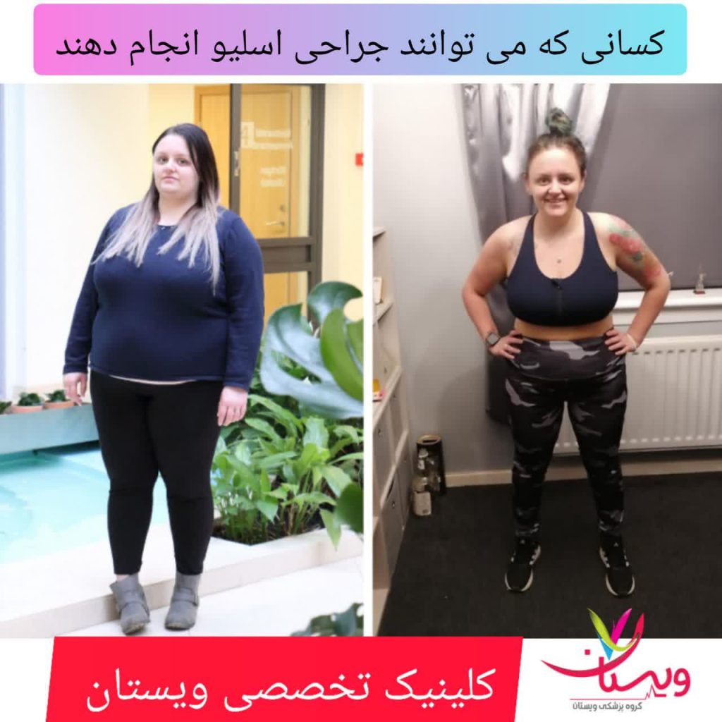 کسانی که کاندیدای عمل اسلیو هستند کسانی که کاندیدای عمل اسلیو هستند