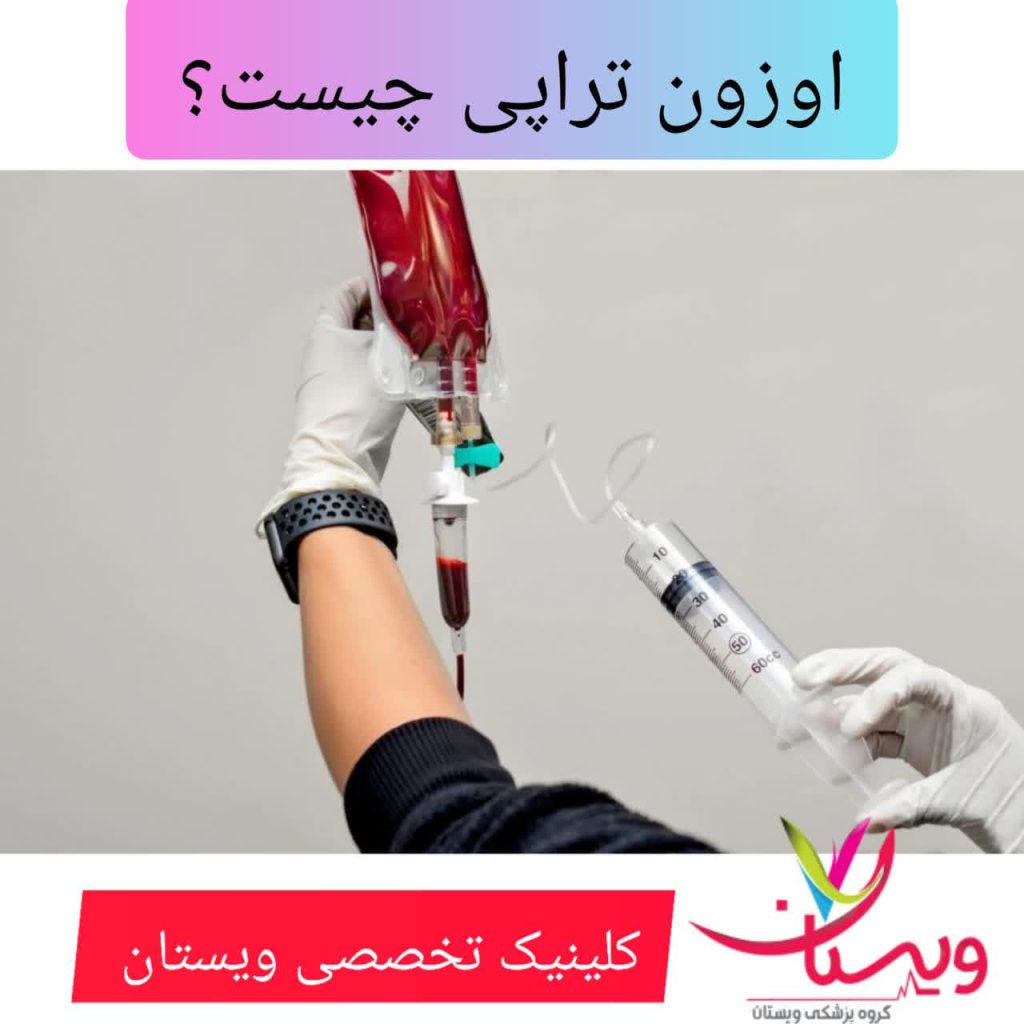اوزون تراپی چیست؟ اوزون تراپی چیست؟