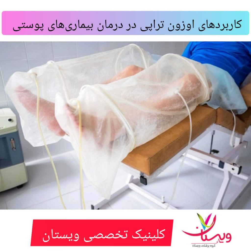 کاربردهای اوزون تراپی برای پوست کاربردهای اوزون تراپی برای پوست