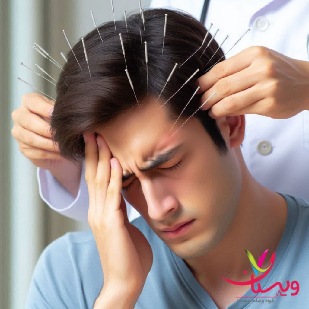 علائم و دلایل سردردهای خوشهای علائم و دلایل سردردهای خوشهای