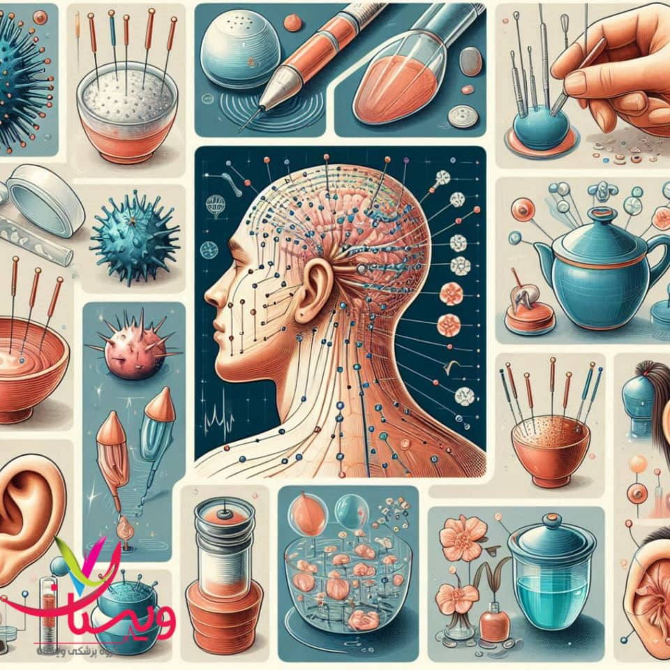 طب سوزنی برای چه مشکلاتی موثر است؟ طب سوزنی برای چه مشکلاتی موثر است؟