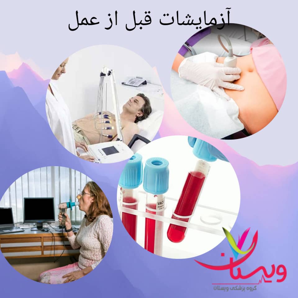 آزمایشات مهم قبل از عمل اسلیو معده آزمایشات مهم قبل از عمل اسلیو معده