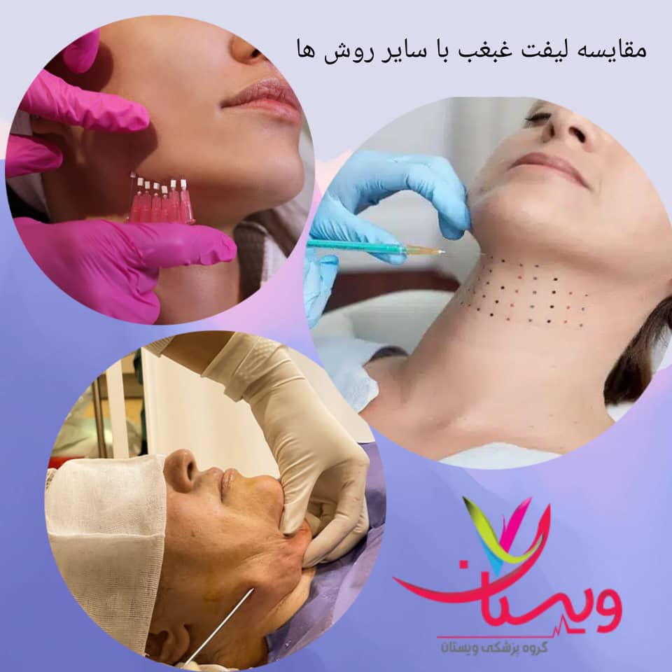 مقایسه امبدینگ غبغب با روشهای دیگر مقایسه امبدینگ غبغب با روشهای دیگر