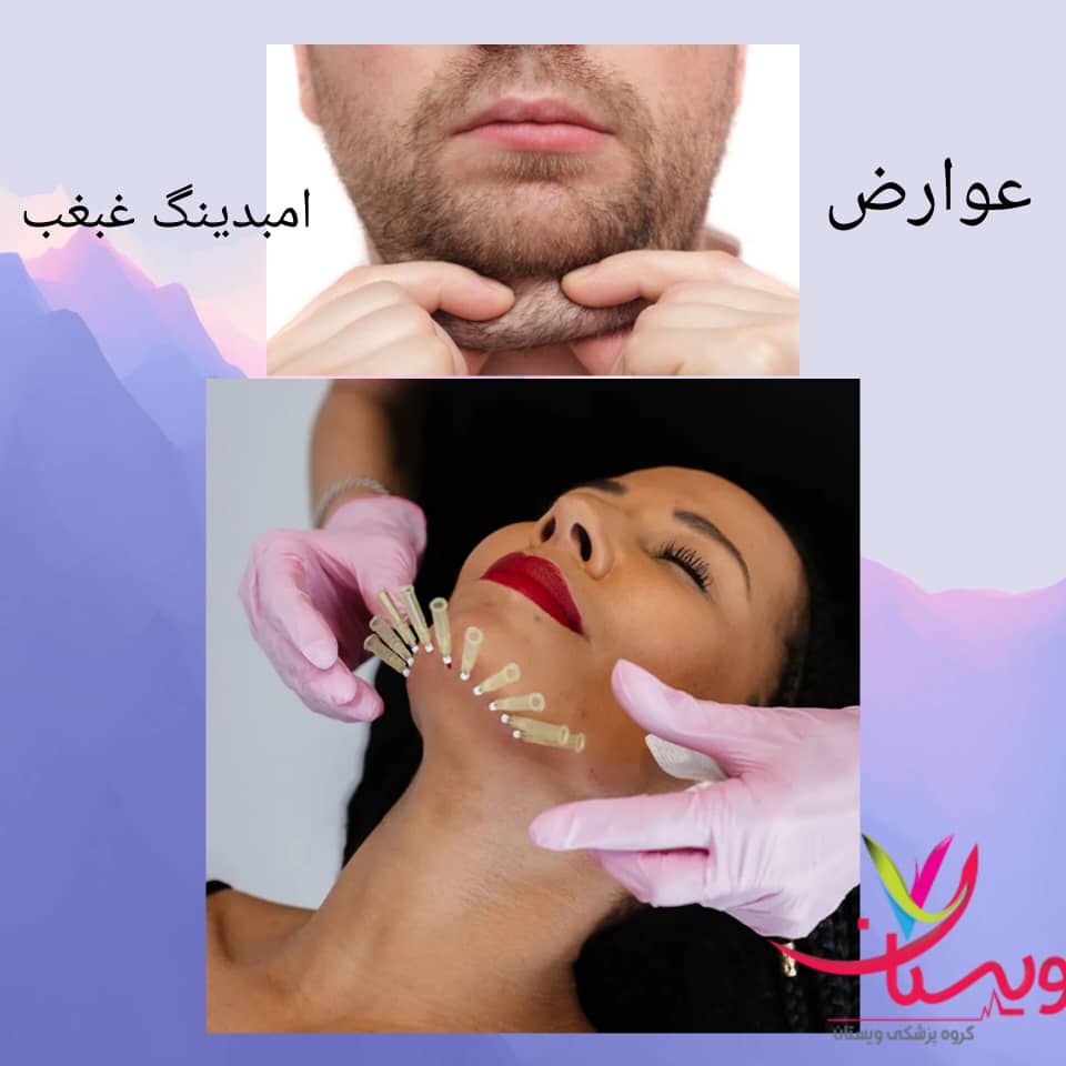 عوارض امبدینگ غبغب عوارض امبدینگ غبغب