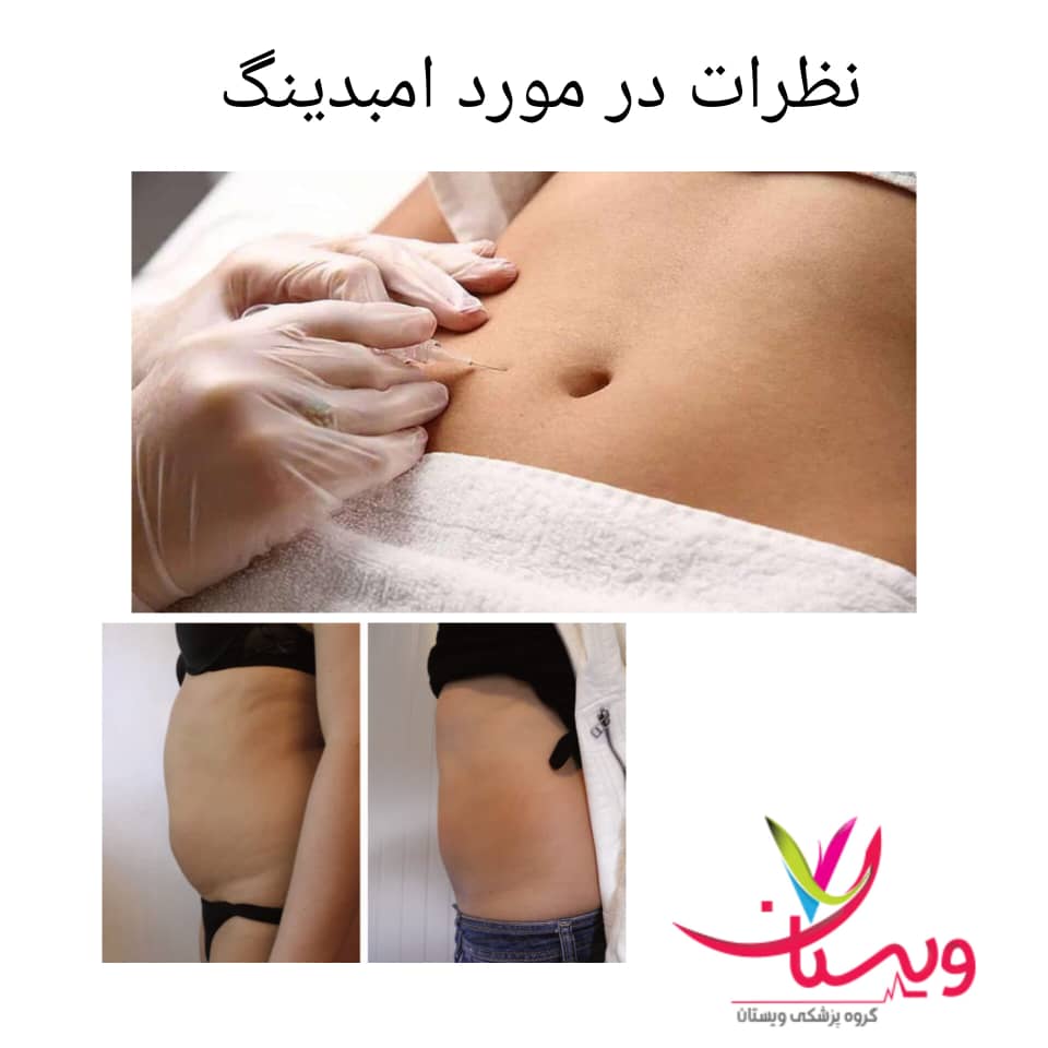 تجربه مراجعهکنندگان کلینیک ویستان در امبدینگ لاغری تجربه مراجعهکنندگان کلینیک ویستان در امبدینگ لاغری
