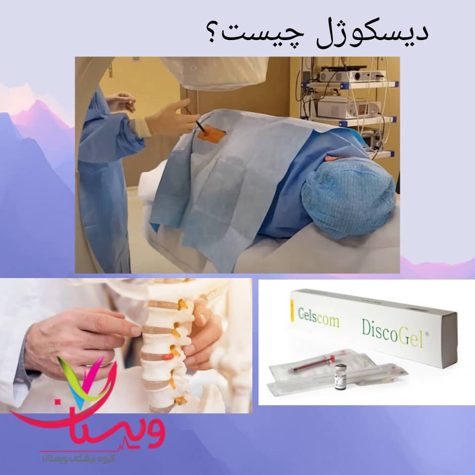دیسکوژل چیست و چگونه عمل میکند؟ دیسکوژل چیست و چگونه عمل میکند؟
