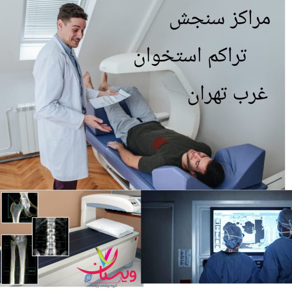 بهترین مراکز سنجش تراکم استخوان در غرب تهران