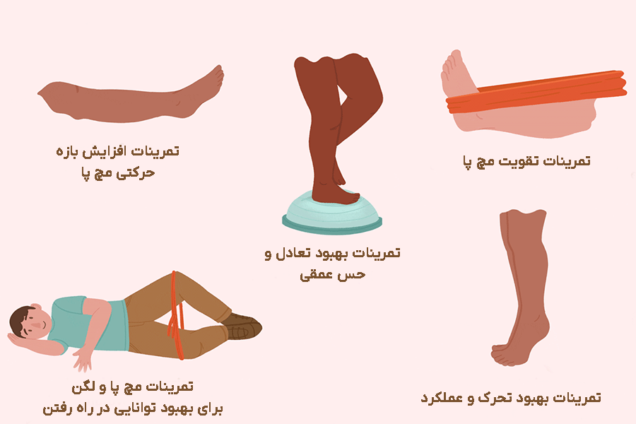 مراقبت های بعد از پی آر پی مچ پا مراقبت های بعد از پی آر پی مچ پا