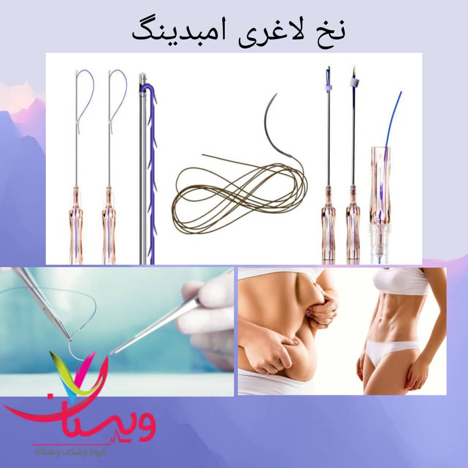نخ لاغری امبدینگ