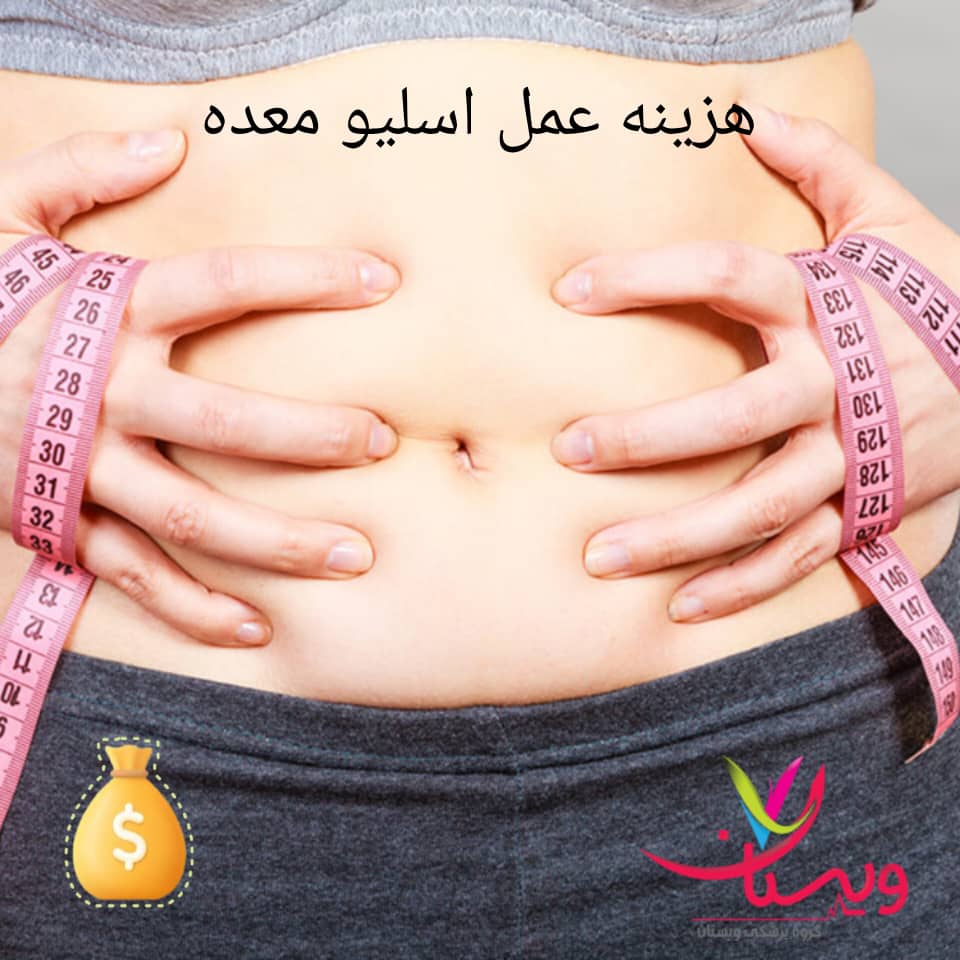 هزینه عمل اسلیو معده