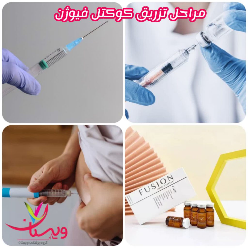 مراحل تزریق کوکتل لاغری مراحل تزریق کوکتل لاغری