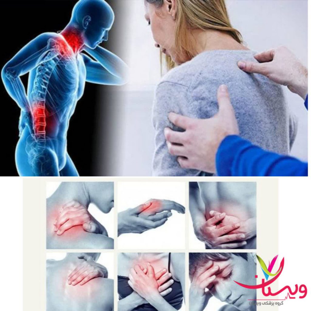 نقاط درد در فیبرومیالژیا نقاط درد در فیبرومیالژیا
