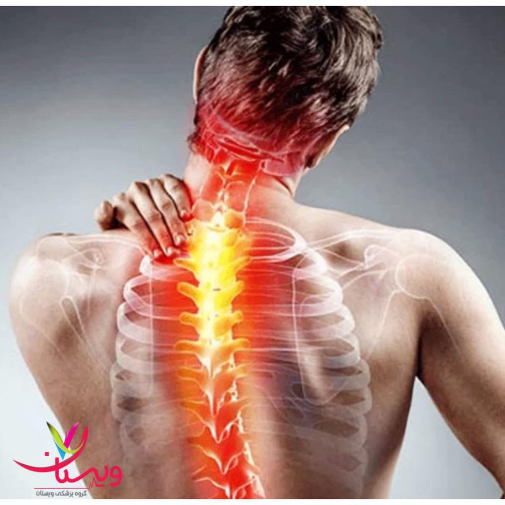 ارتباط فیبرومیالژیا و بیماریهای خودایمنی ارتباط فیبرومیالژیا و بیماریهای خودایمنی
