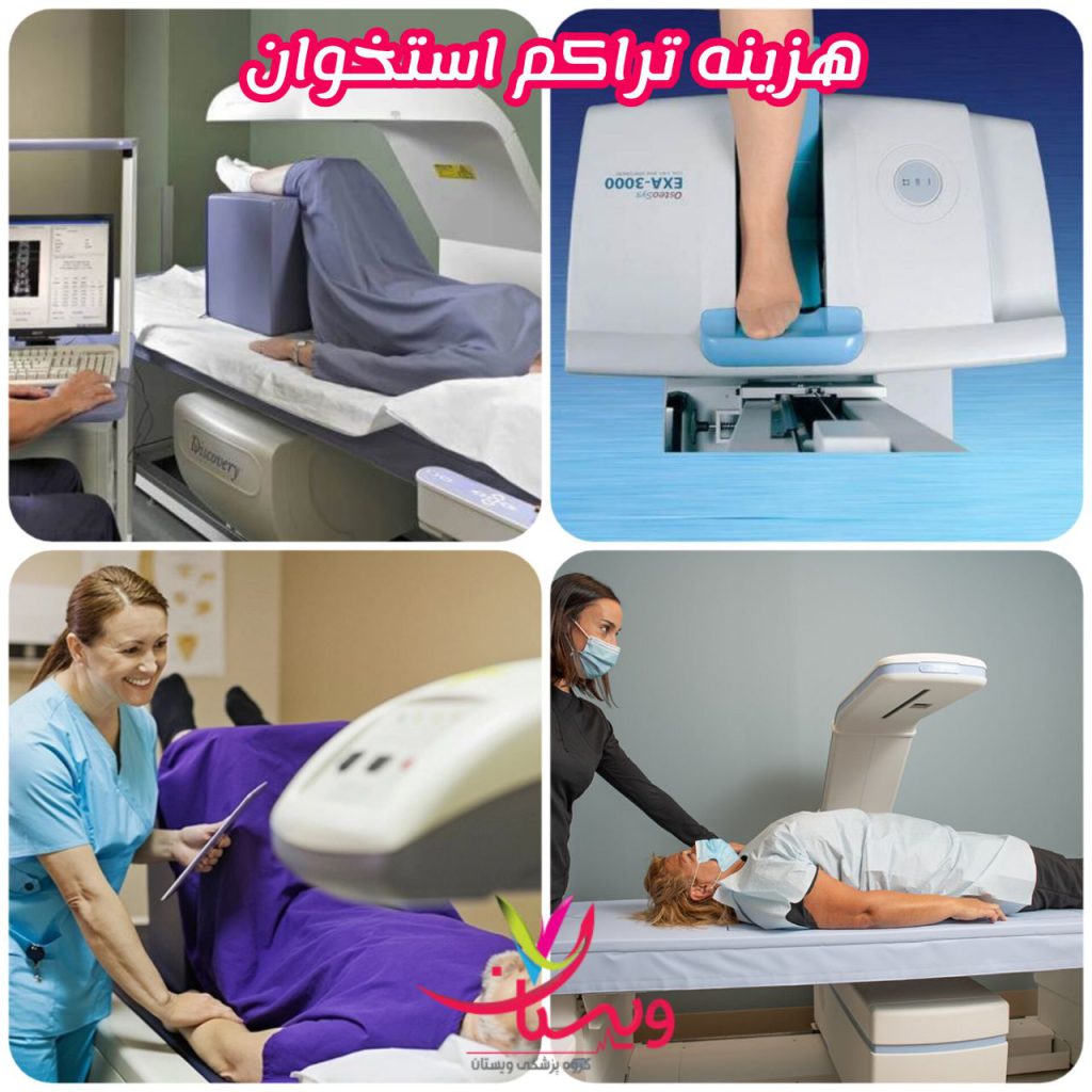 هزینه اسکن سنجش تراکم استخوان هزینه اسکن سنجش تراکم استخوان
