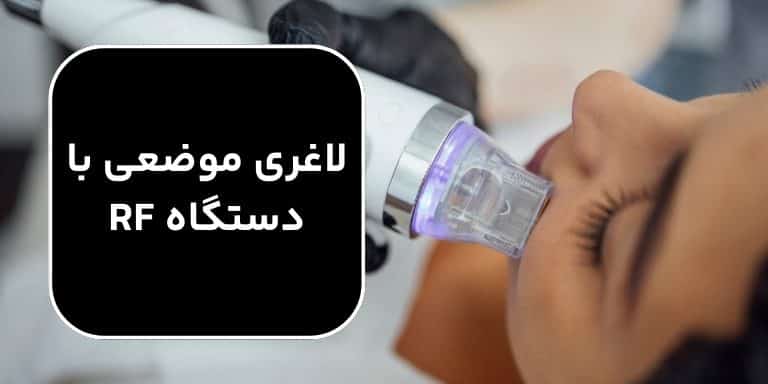 لاغری صورت با دستگاه آر اف لاغری صورت با دستگاه آر اف