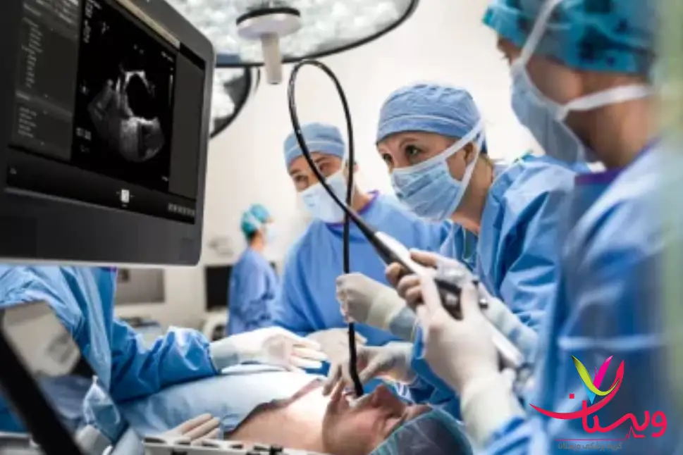 دکتر در حال انجام اکو ترانس ازوفاژیال