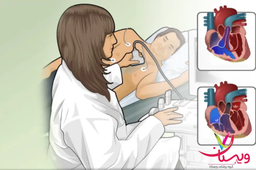 تصویر اینفوگرافی بیمار و پزشک در حال اکوکاردیوگرافی