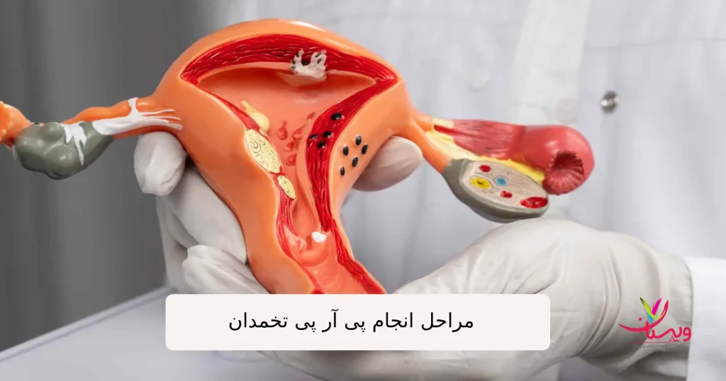 ماکت اندام تناسلی زنان در دست یک پزشک