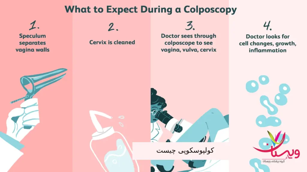 یک تصویر اینفوگرافیک از مراحل انجام کولپوسکوپی