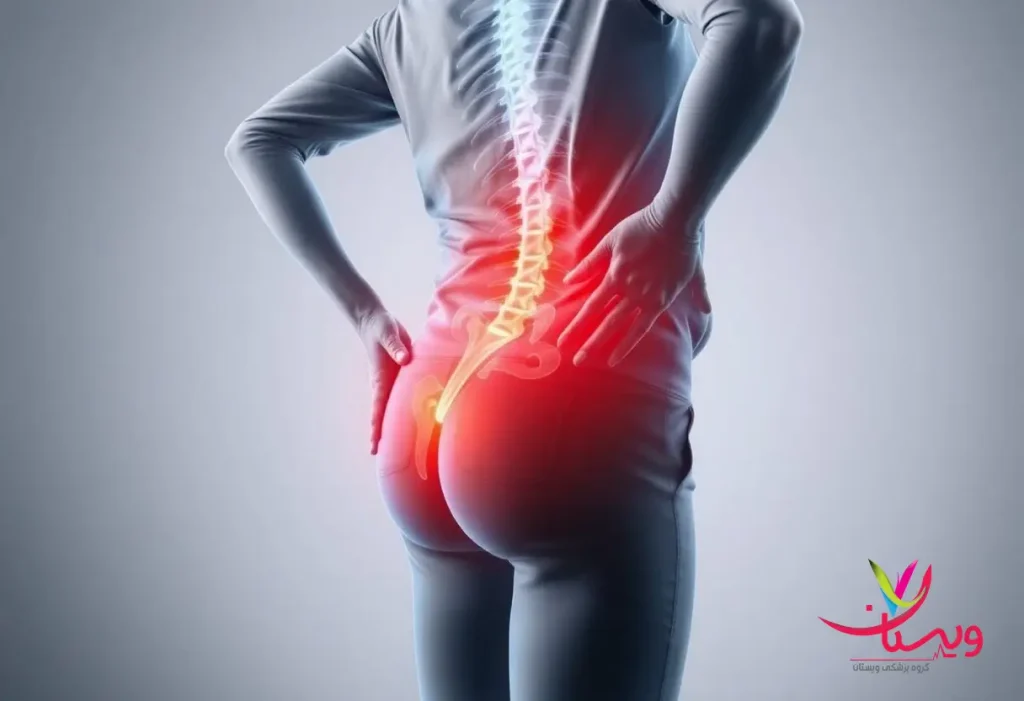 یک فرد دارای سیاتیک
