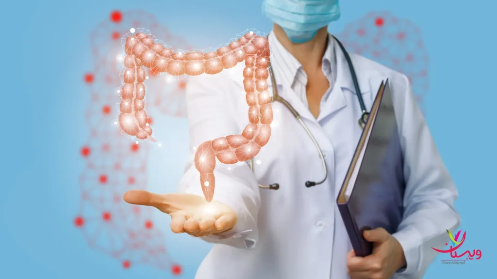 معرفی بهترین جراح پولیپ روده در تهران +روشهای نوین درمان آن