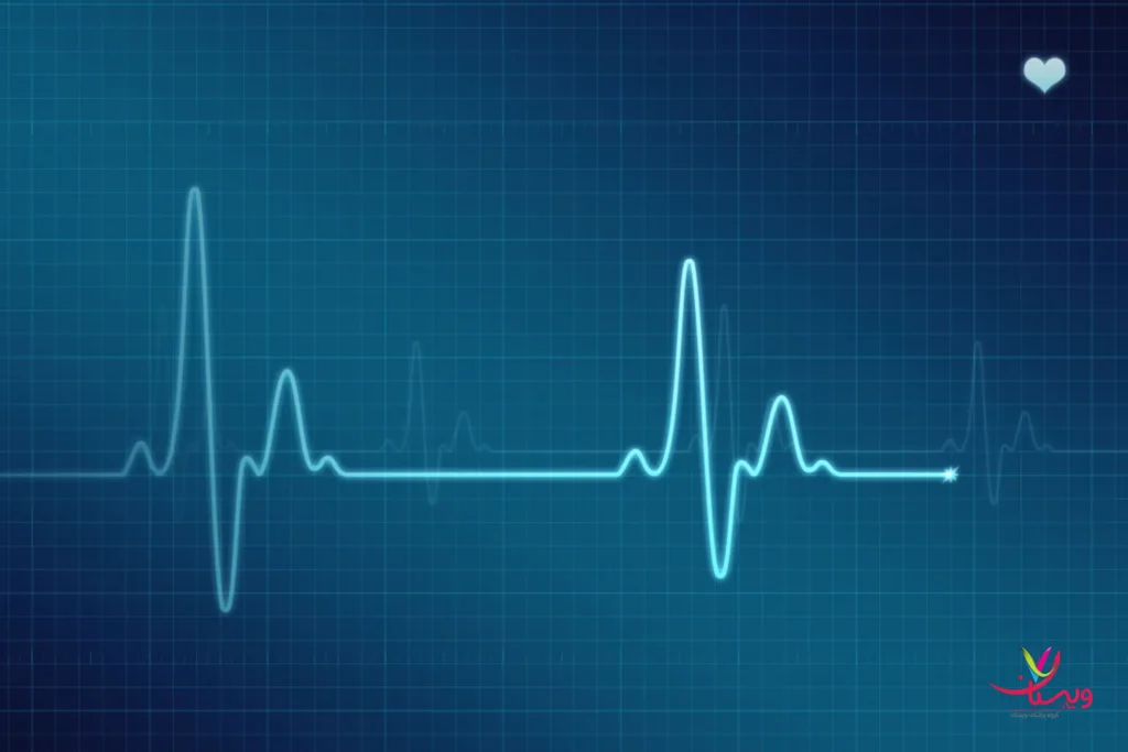 ضربان قلب نامنظم