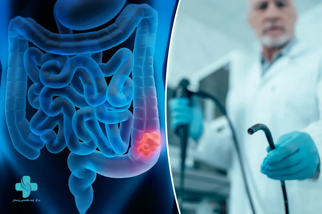 معرفی بهترین مراکز کولونوسکوپی در تهران + هزینه آن