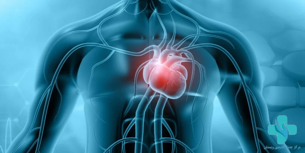 راهنمای کامل میوکاردیت در کودکان و بزرگسالان +علائم و درمان آن
