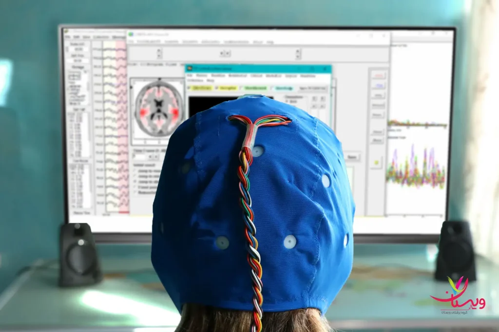 هزینه درمان با لورتا نوروفیدبک | تعرفههای بهروز در مراکز معتبر