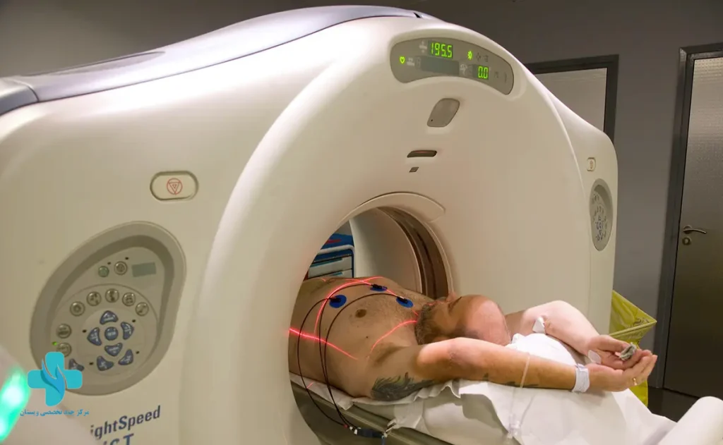 بیمار در حال انجام آنژیو