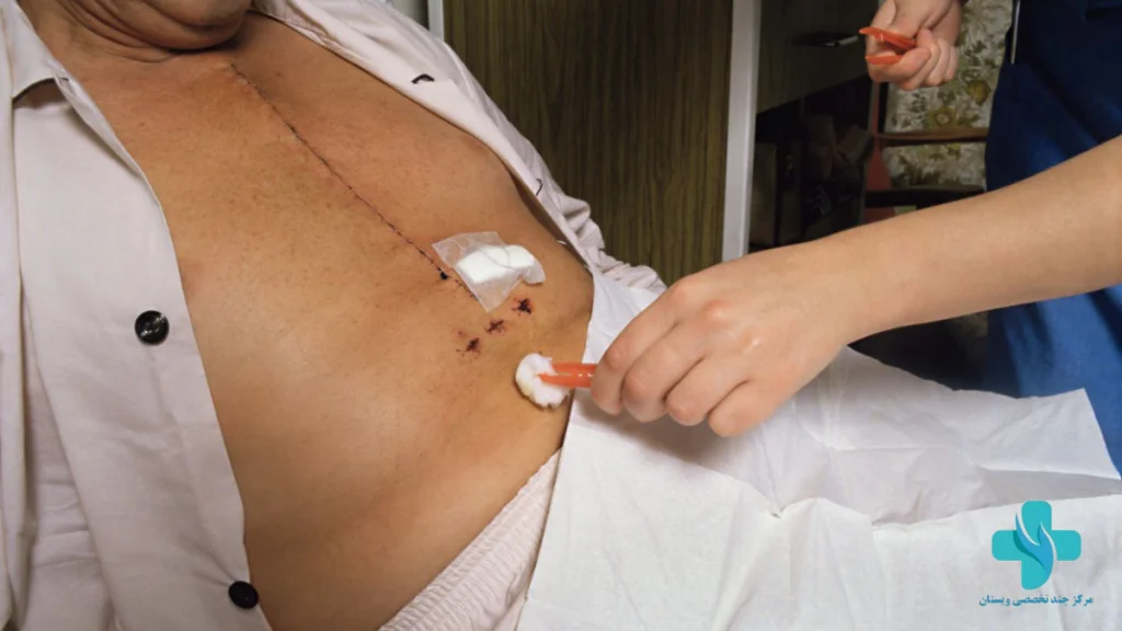 بیمار بعد از عمل قلب