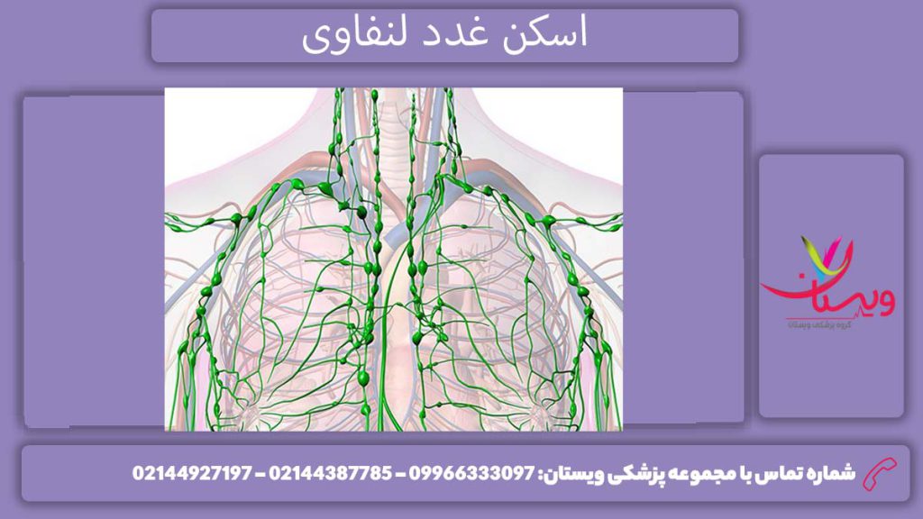 تصویربرداری هستهای غدد لنفاوی اسکن هستهای غدد لنفاوی چیست؟