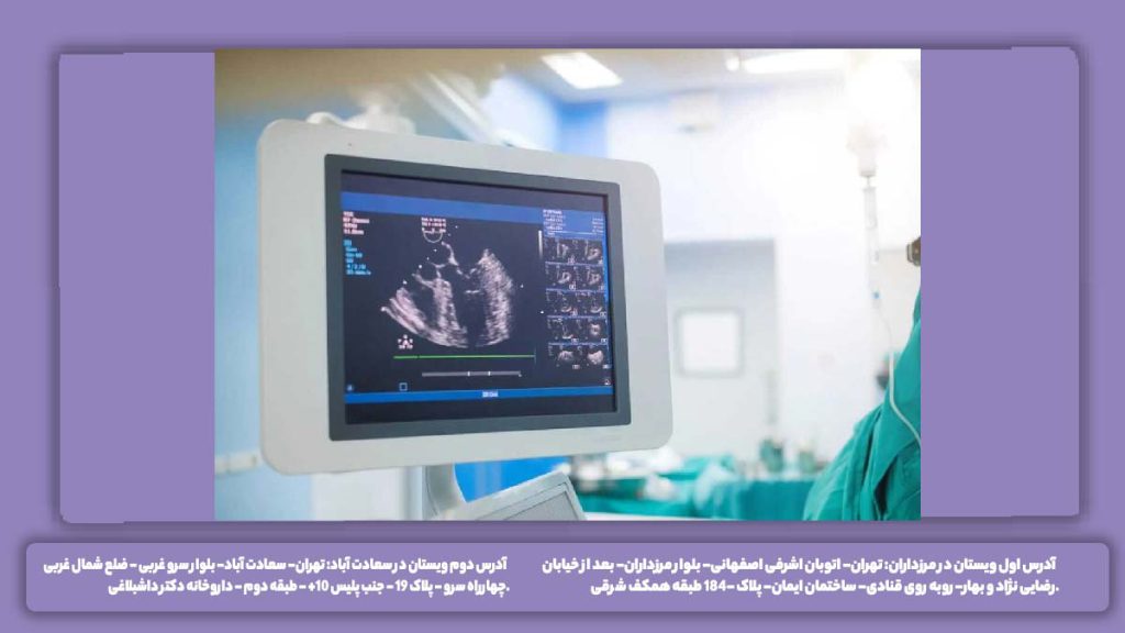 چگونگی فرایند اکوی فلوشیپ اکو فلوشیپ چگونه انجام میشود؟