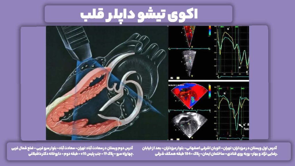 اکوی داپلر تیشو قلب اکوی تیشو داپلر قلب