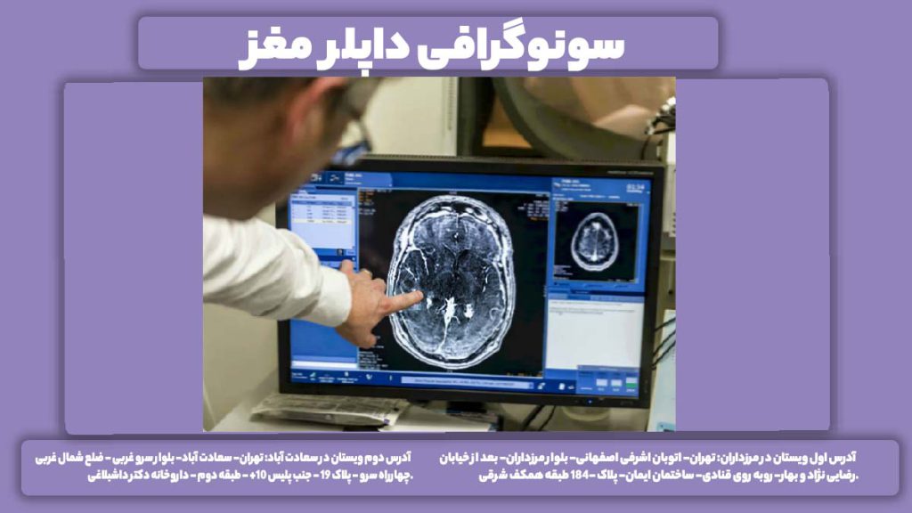 اکوی مغز رنگی سونوگرافی داپلر مغز