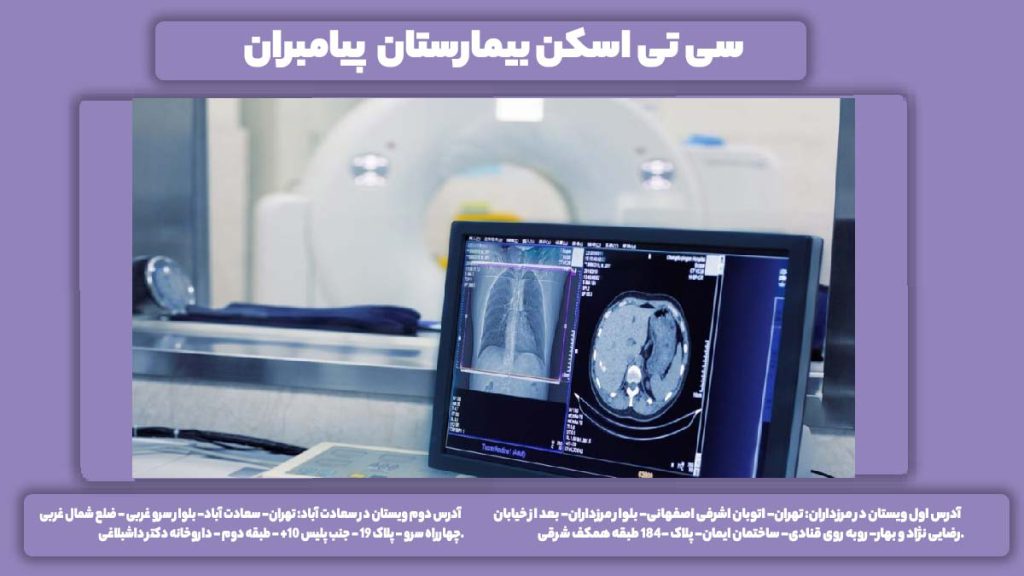 شماره ct اسکن بیمارستان پیامبران سی تی اسکن بیمارستان پیامبران