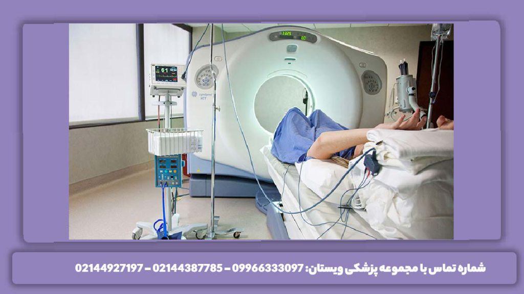 مراحل آنژیوگرافی مغزی مرحلههای سی تی آنژیو عروق مغزی