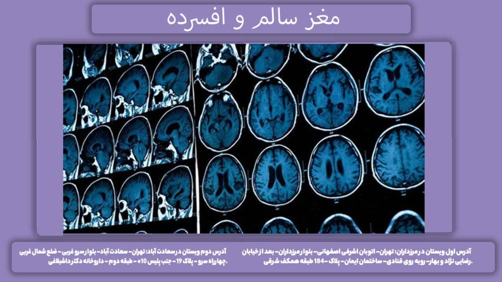 مغز سالم و افسرده مغز افراد سالم و افسرده چه فرقی دارد؟
