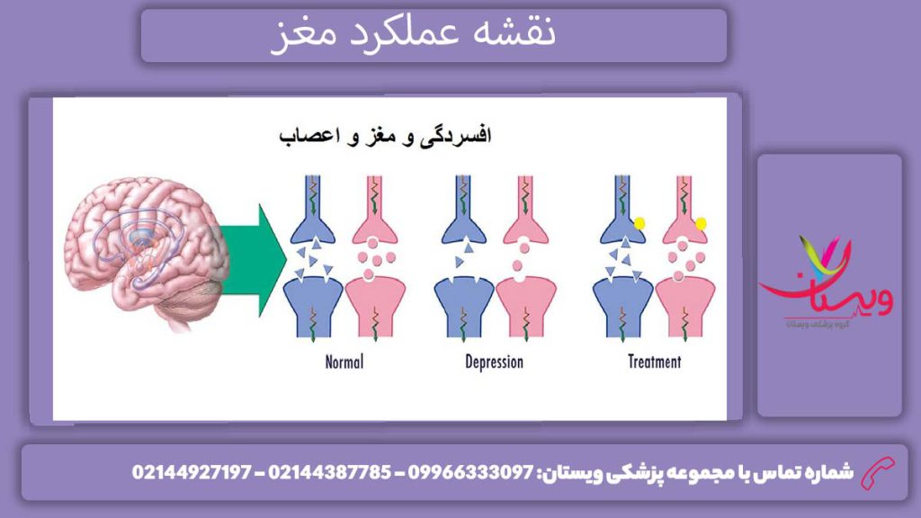 تحلیل نقشه مغزی افراد افسرده بررسی نقشه مغزی فرد افسرده