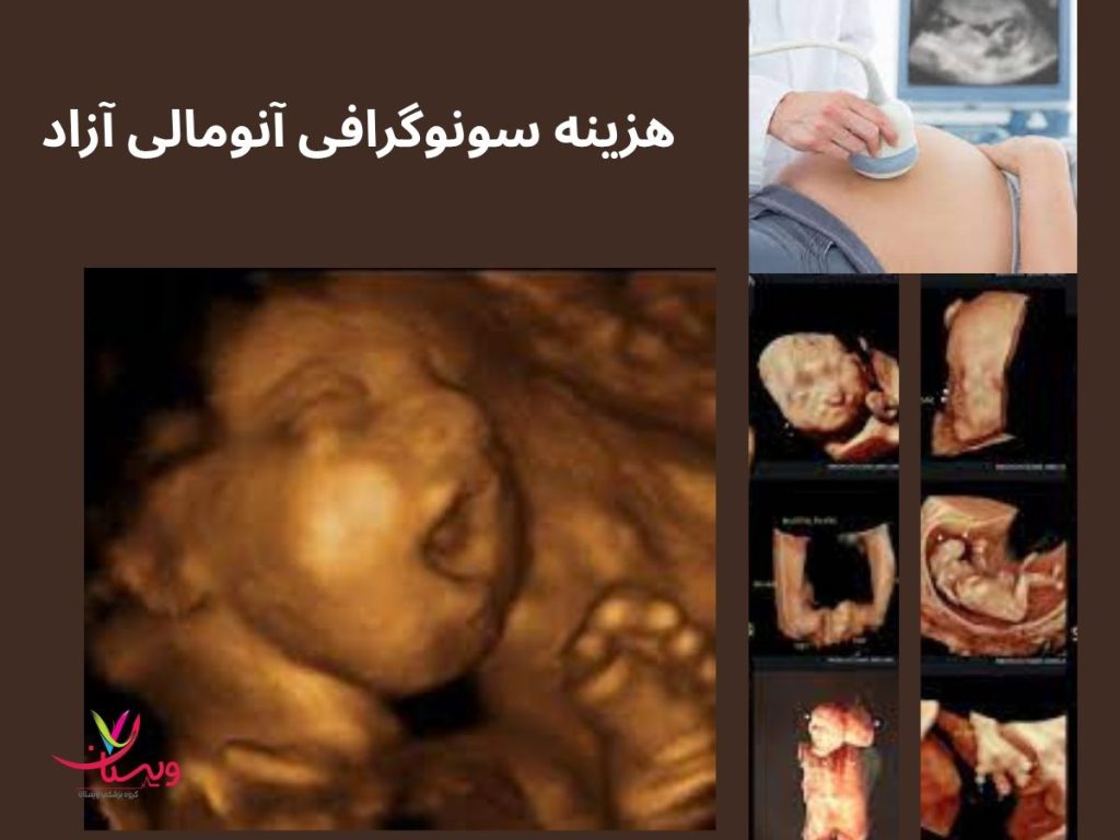 سونو آزاد هزینه سونوگرافی آنومالی آزاد