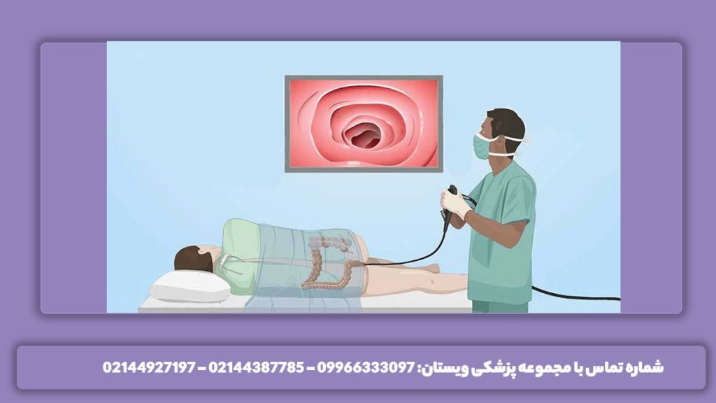 احتیاج به کولونوسکوپی با بیهوشی ضرورت نیاز به کولونوسکوپی بدون بیهوشی