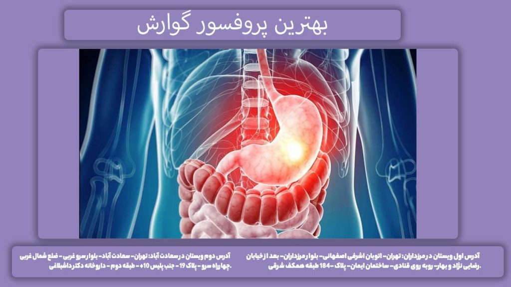 دکترهای پروفسور گوارش پروفسور گوارش در تهران
