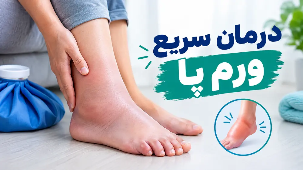 درمان سریع ورم پا