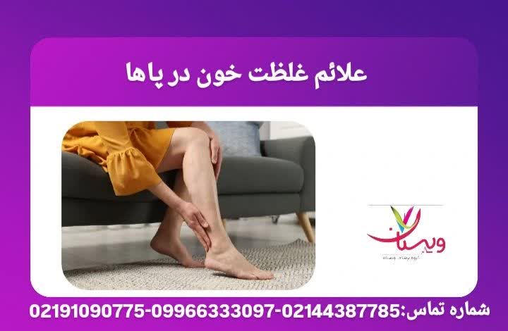 تورم، سنگینی و تغییر رنگ پاها بهعنوان علائم اولیه اختلال گردش خون. علائم غلظت خون در زنان