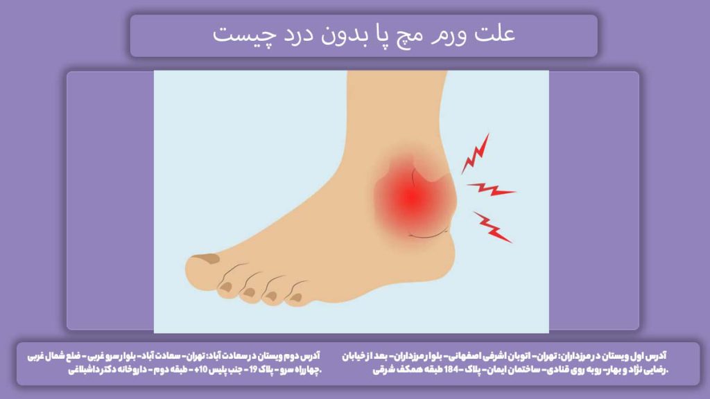 دلیل پف کردن قسمت مچ پا علت ورم مچ پا بدون درد چیست