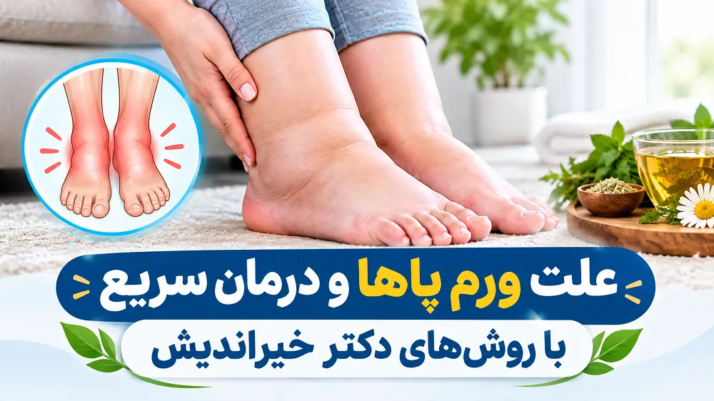 علت ورم پاها و درمان سریع با روش های دکتر خیراندیش